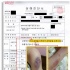 金賢重女友被毆診斷書曝光 胸臉等多處有外傷
