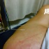 汪东城针灸惹粉丝心疼 自我调侃：打开任督二脉