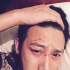 陸毅眼部受傷曬照疤痕明顯 求助網(wǎng)友尋消腫法