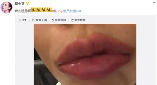 半夜偷吃"麻小"还晒照的下场!蔡少芬变"香肠嘴"