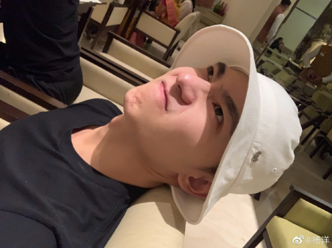 杨洋晒素颜自拍上火冒痘 皱鼻卖萌纠结是否要吃饭