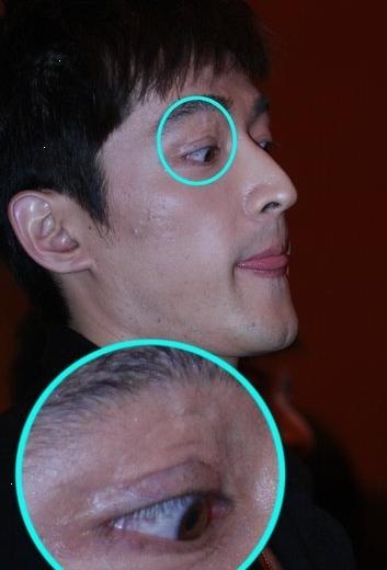 眼皮仍有伤疤也许,平添了几分成熟的气质胡歌亲笔撰文悼念女助手从耳