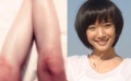 王珞丹曬受傷玉腿照 網(wǎng)友調(diào)侃稱(chēng)其為“內(nèi)涵圖”