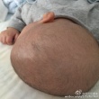 范玮琪用母乳治愈爱子头上痘痘 大呼“神奇”