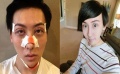 蛇精男自曝整容照眼皮浮腫 將進(jìn)行第三次大整容