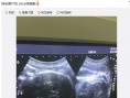 林志穎變身奶爸給二胎寶寶拍嗝 寶寶露后腦勺