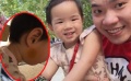 黃毅清曬女兒臉部淤青照 稱將起訴黃奕涉嫌虐童