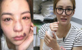 女星签“生死状”参加真人秀 被暴打留伤险毁容