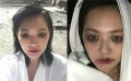 小S新造型满脸淤青 网友：失业少妇又被家暴