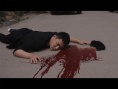 左眼陰陽