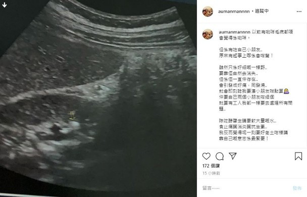 張致恒太太自曝身體出現(xiàn)毛病