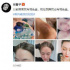 張馨予曬出腿部淤青照：現(xiàn)在跳舞我也有調(diào)色盤