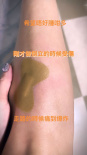 张柏芝倒立失手跌伤脚 小腿红肿直呼“痛到爆炸”
