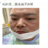 岳云鹏扎针灸晒照 画面搞笑却被医生嘱咐不许笑