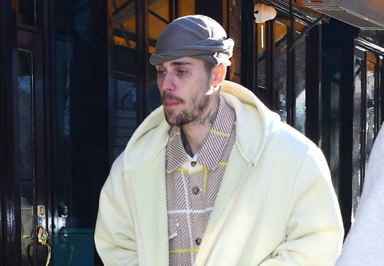 状况堪忧？多名医生“诊断”贾斯汀·比伯健康受损