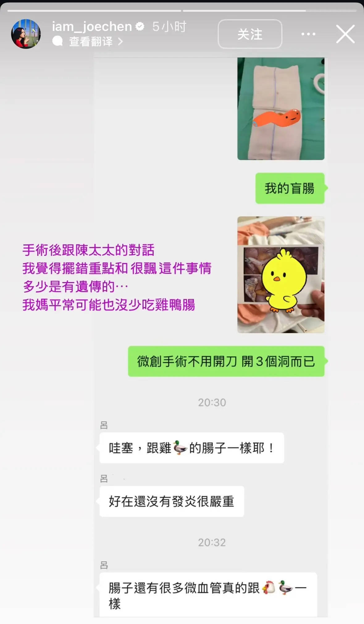 陈乔恩自曝突患盲肠炎，为不影响工作选择当天手术